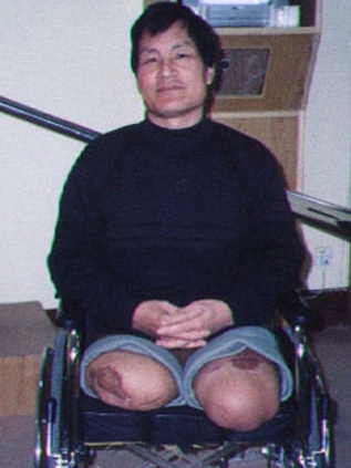 裝配案例